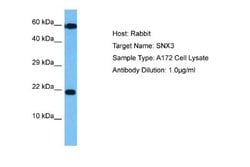 SNX3 Antibody, Novus Biologicals 100 &mu;L | Buy Online | Novus Biologicals | Fisher Scientific